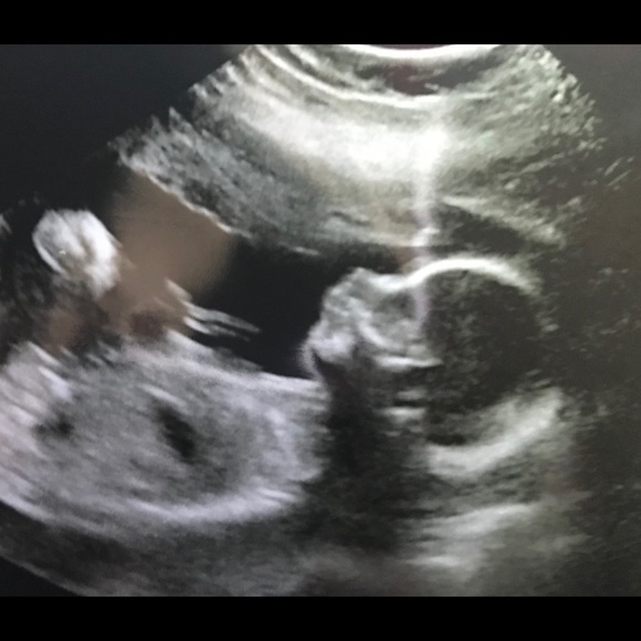 Meet your Posher, Samantha - Picture 1 of 1